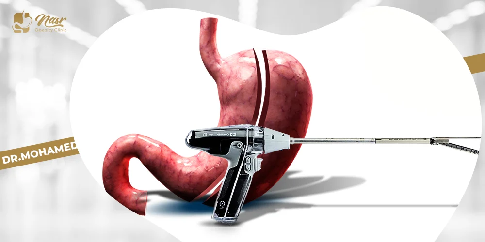 شكل دبابيس المعدة