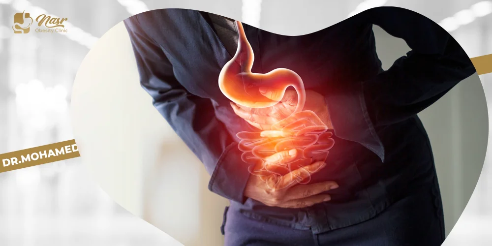 الآثار الجانبية لعملية تكميم المعدة