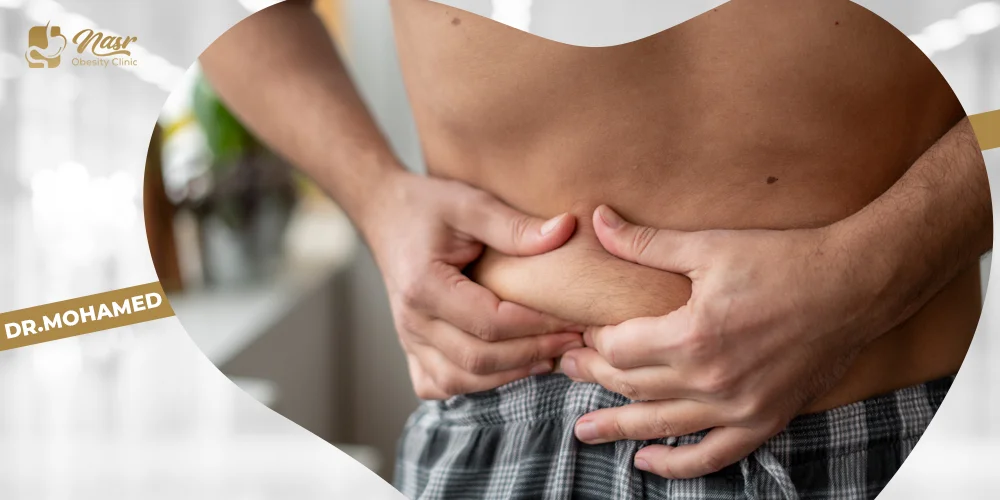 الترهلات بعد التكميم الترهلات بعد التكميم