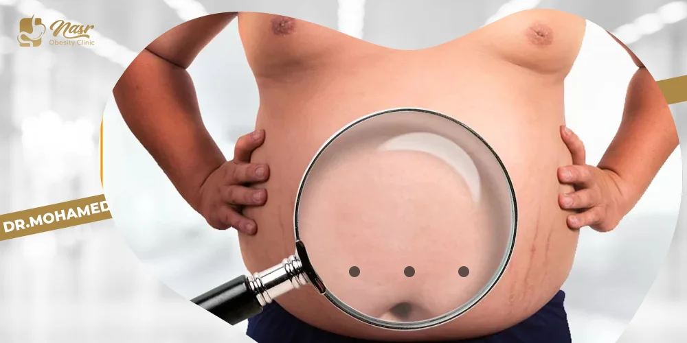 عملية تكميم البكيني