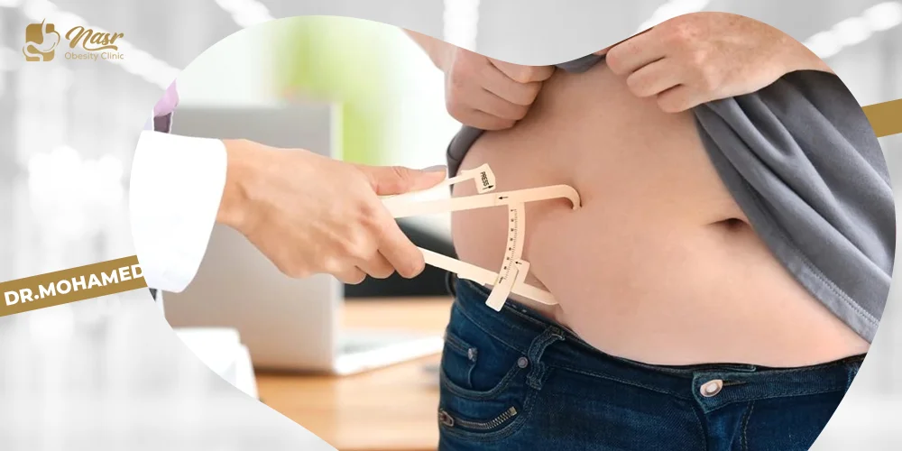 علامات توسع المعدة بعد التكميم