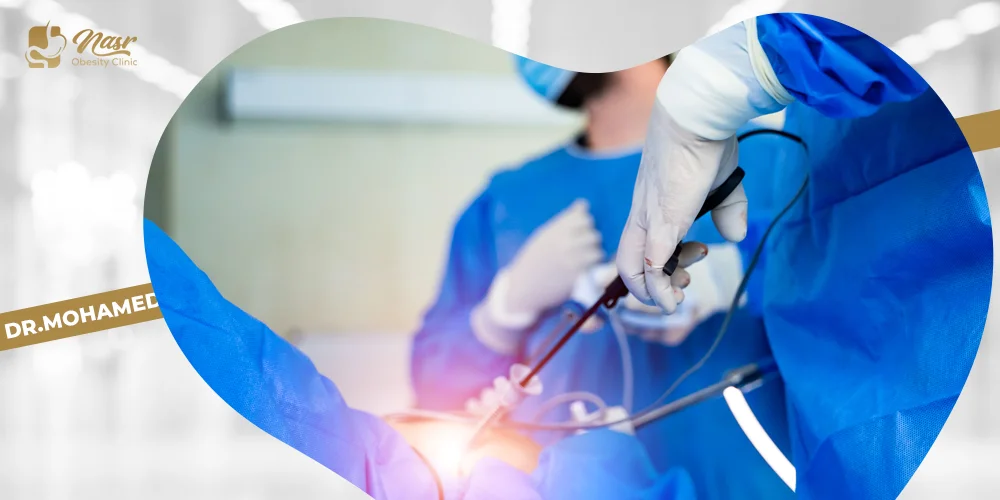 مخاطر عملية تكميم المعدة
